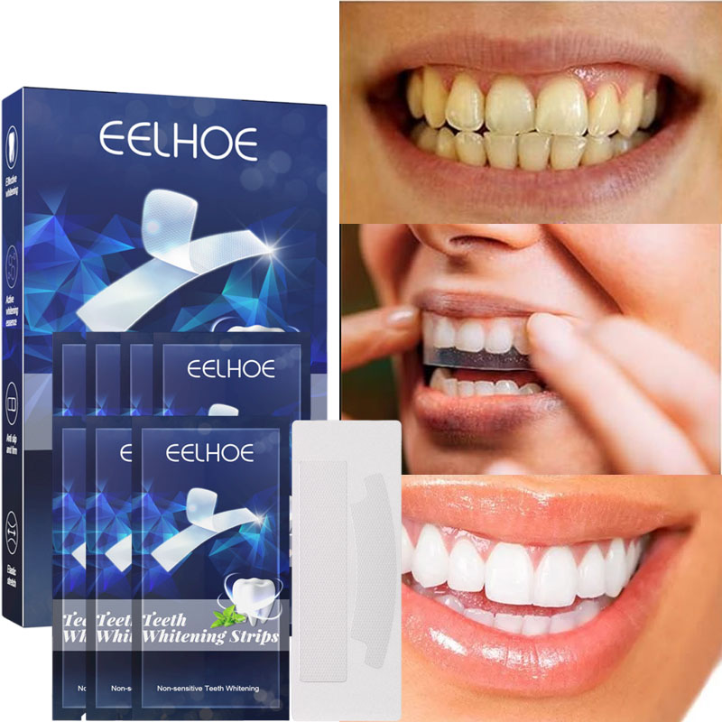 Teeth Whitening Gel Refills - Aufkleber zur Zahnaufhellung, Minze, weiße Zähne,