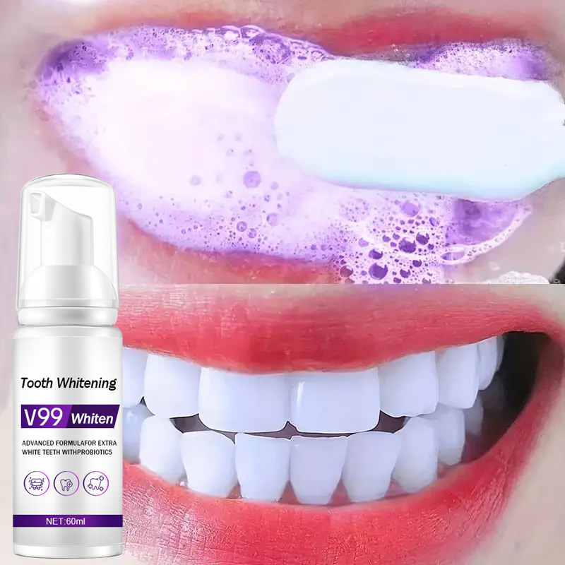 Teeth Whitening Mousse - Mousse V99 Zahnpasta, Zahnreinigung, wirksame aufhellende