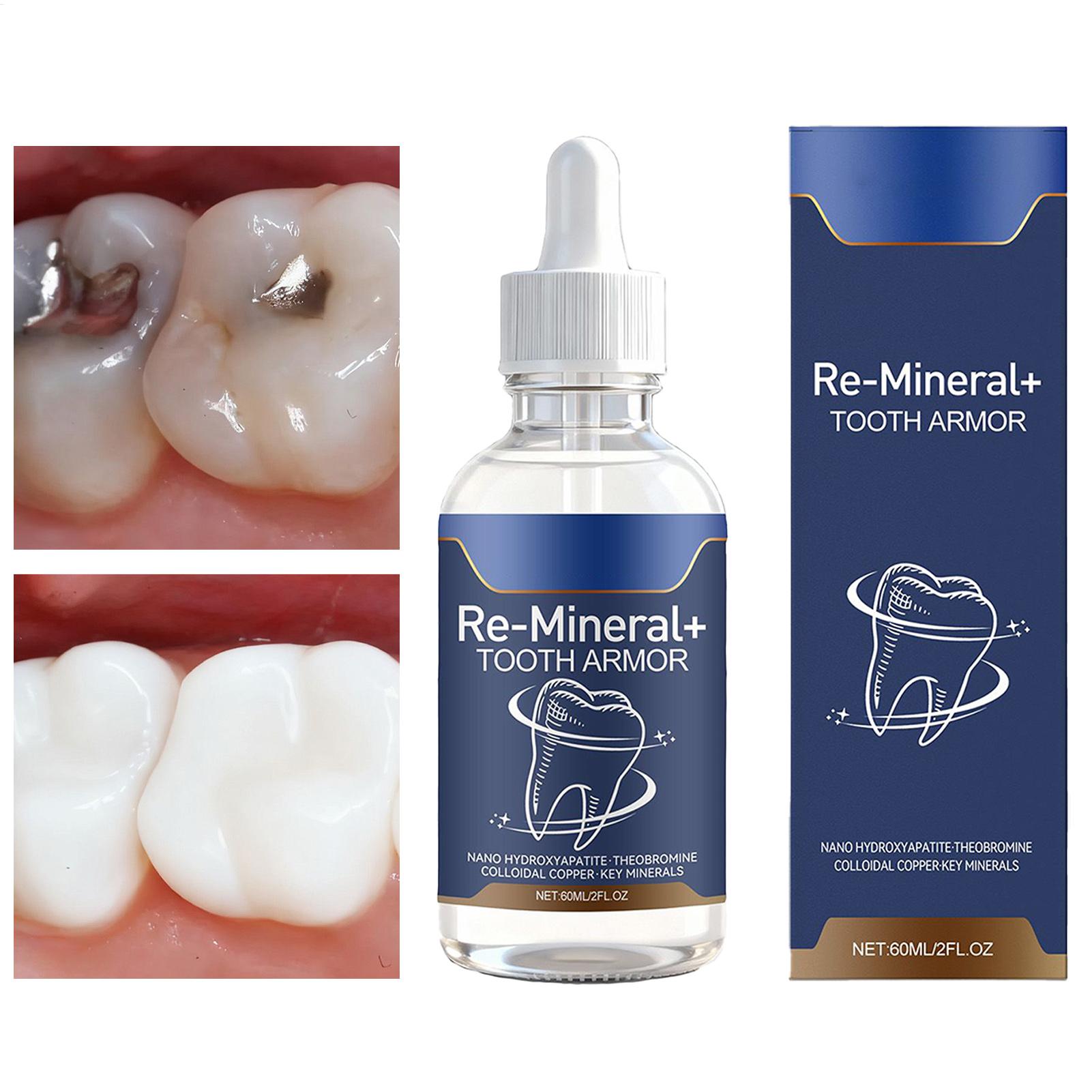 Teeth Whitening Products - 60 ml Zahnreinigungsflüssigkeit entfernt Zahnflecken, Zahnweißung,