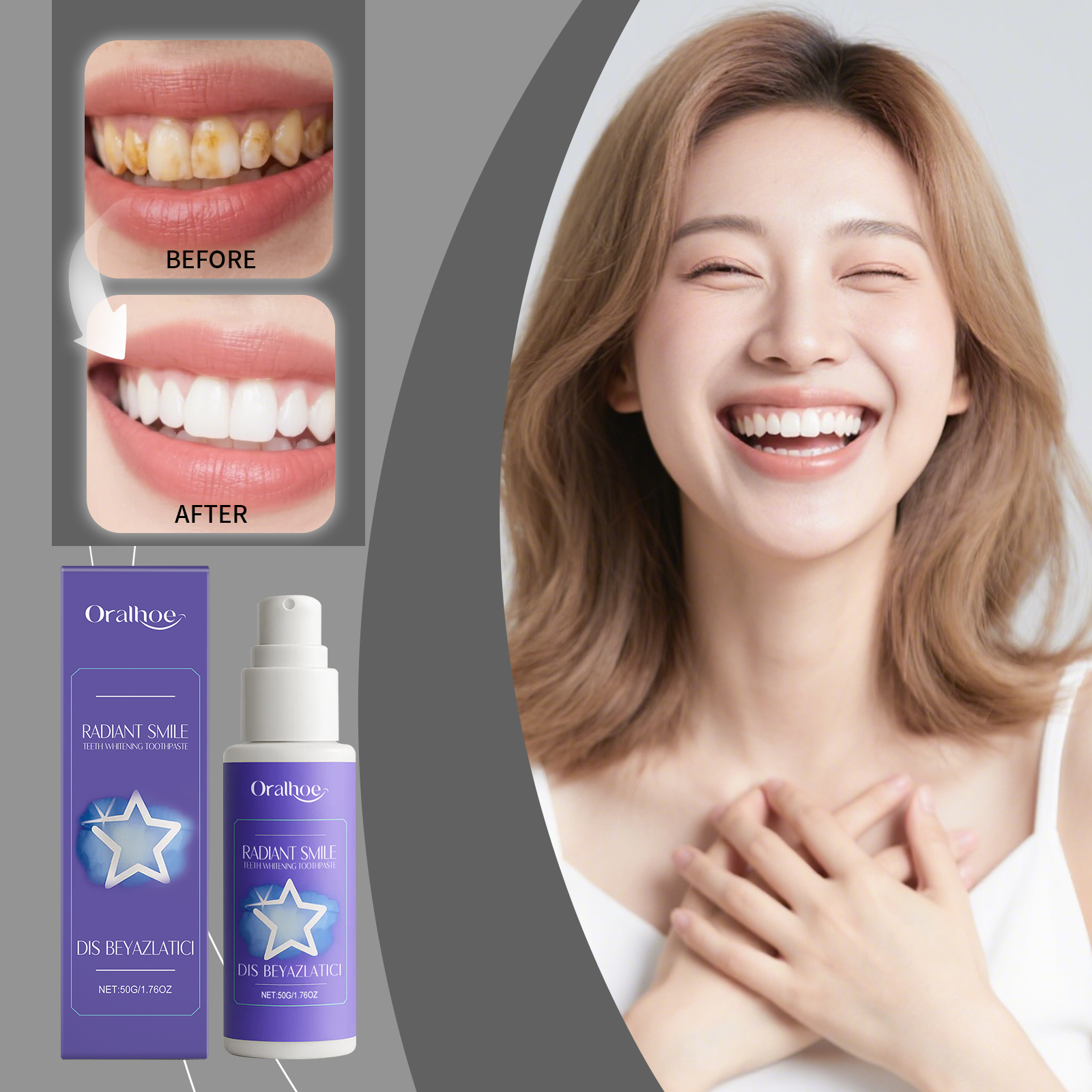 Teeth Whitening Or Bleaching - ORALHOE 50g Lila Zahnaufhellungs-Zahnpasta - Plaque-