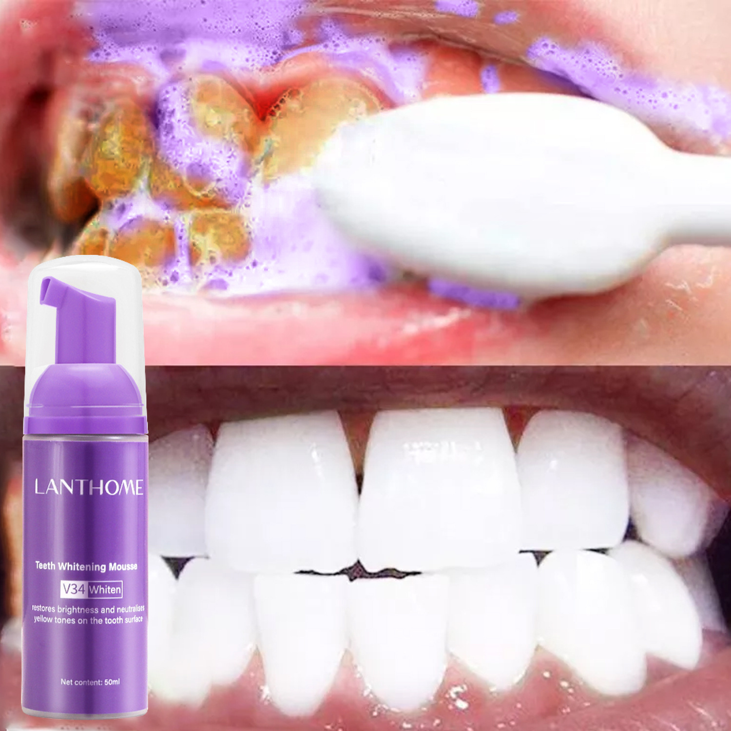 Teeth Whitening Mousse - V34 Zahnaufhellung Mousse Zahnpasta Entfernen Plaque