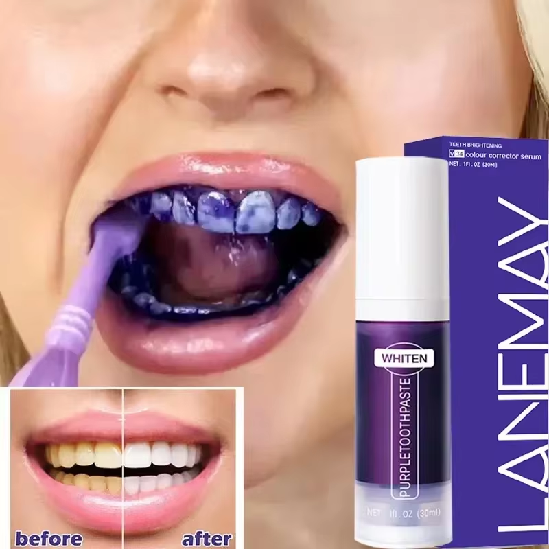 Teeth Whitening Mousse - V34 Lila Zähne Bleaching Zahnpasta Entfernen