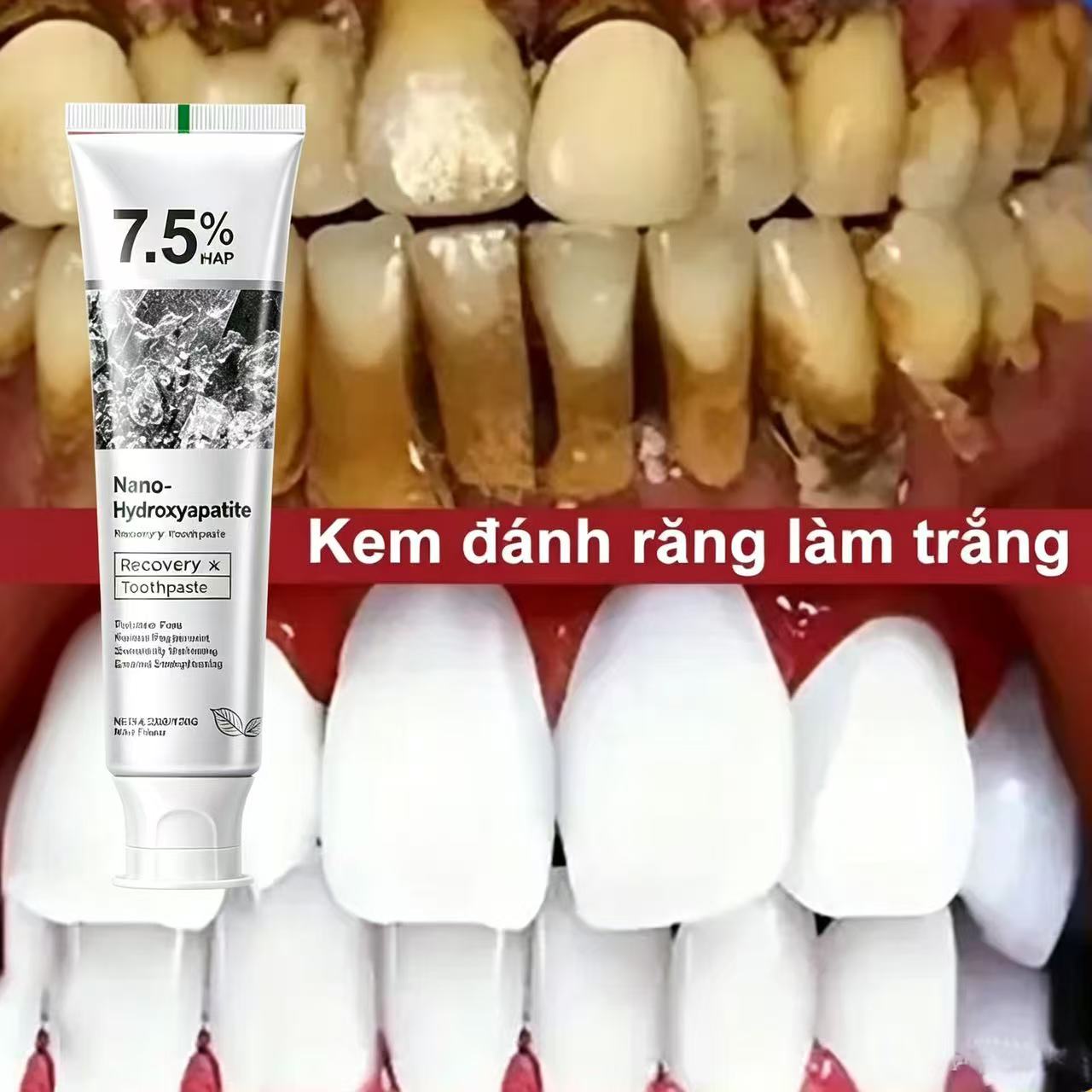 Teeth Whitening Best - 7,5% Hydroxyapatit Probiotische Zahnaufhellungs-Zahnpasta Zahnschmelz- und
