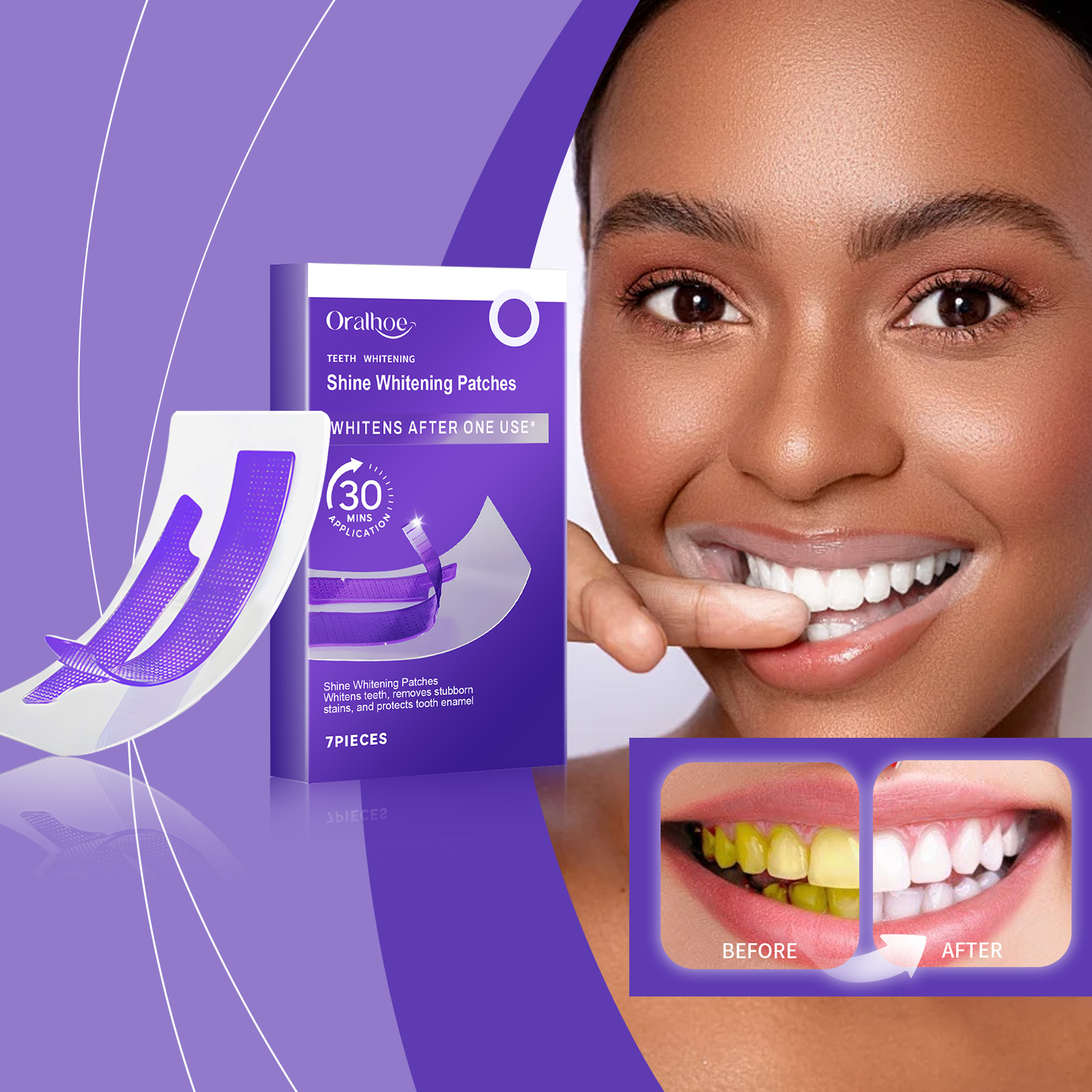 Teeth Whitening Gel Refills - 7PCS Bleaching reinigung Zähne Aufkleber 30