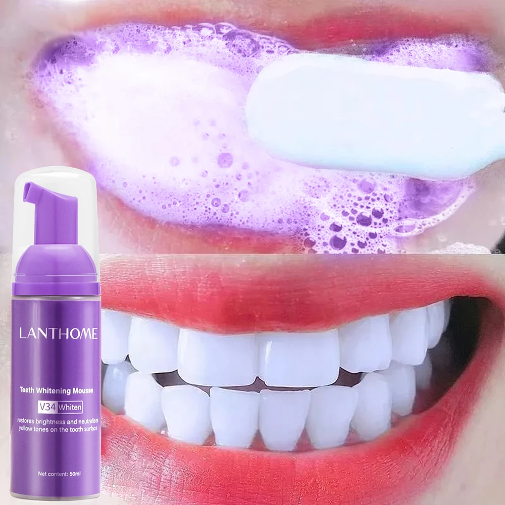 Teeth Whitening Mousse - Mousse v34 Zahnpasta Zahn reinigung effektive