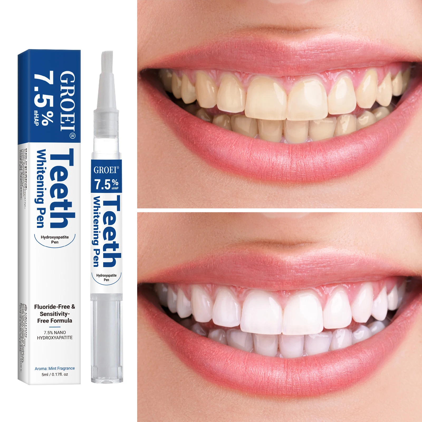 Hydroxyapatite Zahnaufhellungs – Teeth Whitening Q&M Bewertung und Preis