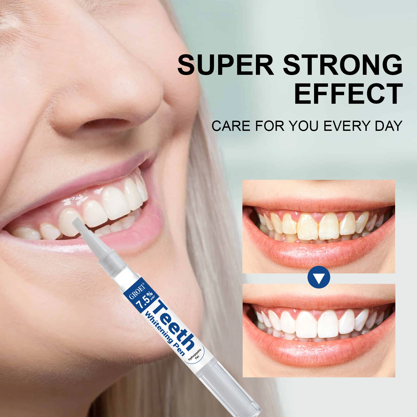 Hydroxyapatite Zahnaufhellungs – Teeth Whitening Q&M Bewertung und Preis