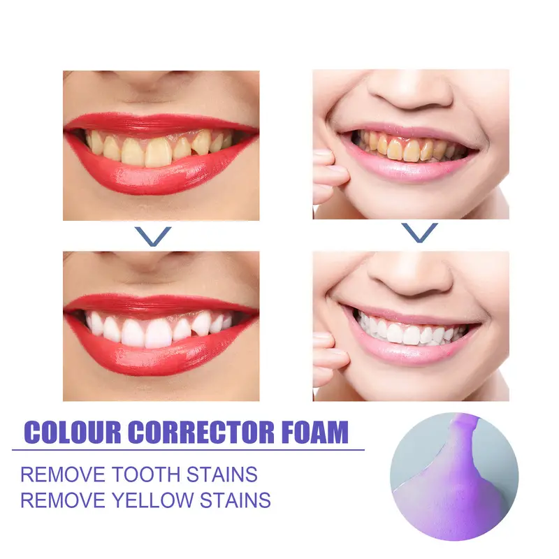 Mousse V99 Zahnpasta, Zahnrein – Teeth Whitening Mousse Bewertung und Preis
