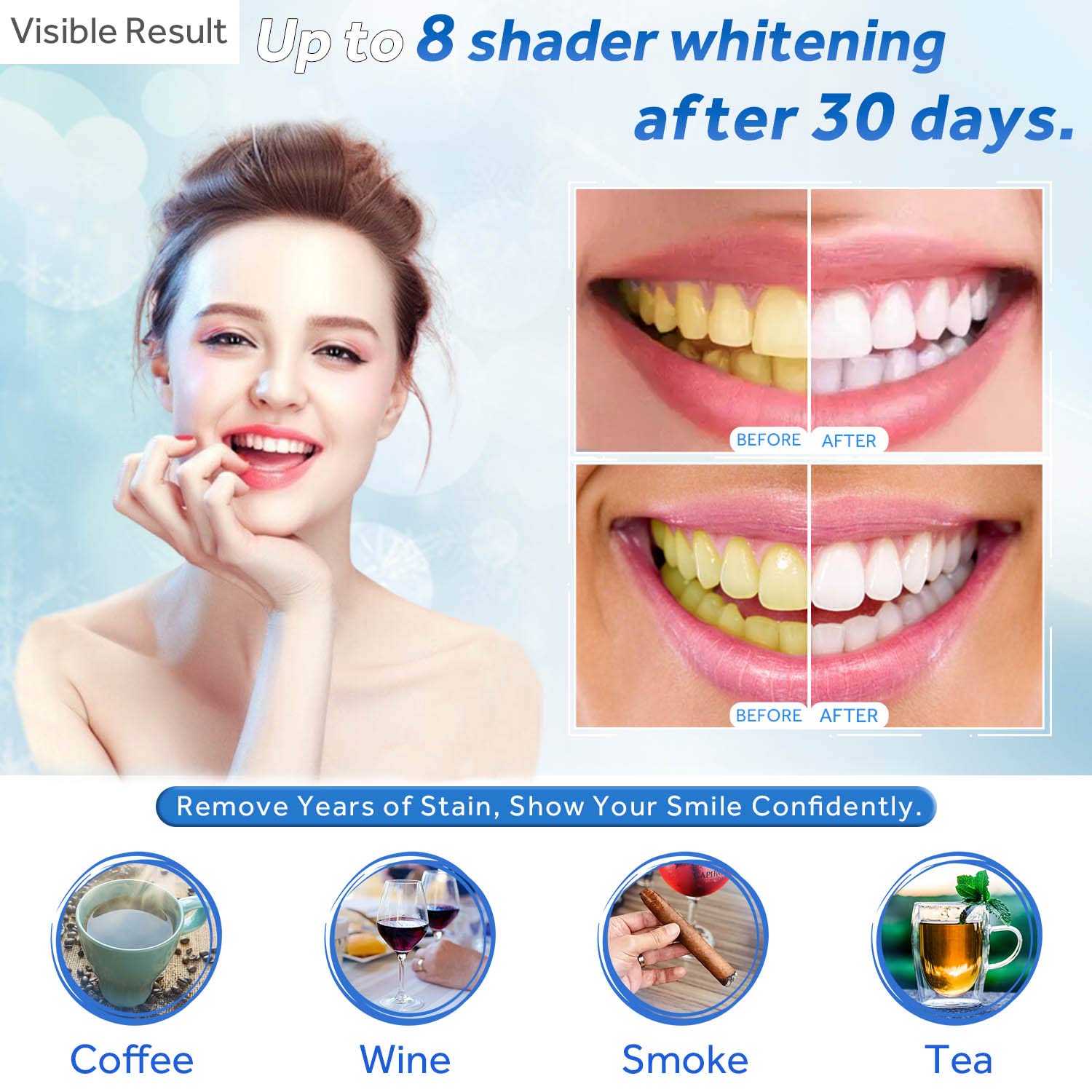 Zahnaufhellungsgel, Nachfüllsp – Teeth Whitening Gel Refills Bewertung und Preis