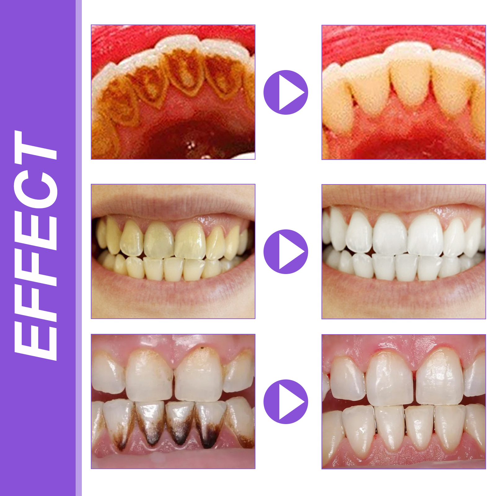 EELHOE Smiles Bright White Ref – Teeth Whitening Mousse Bewertung und Preis