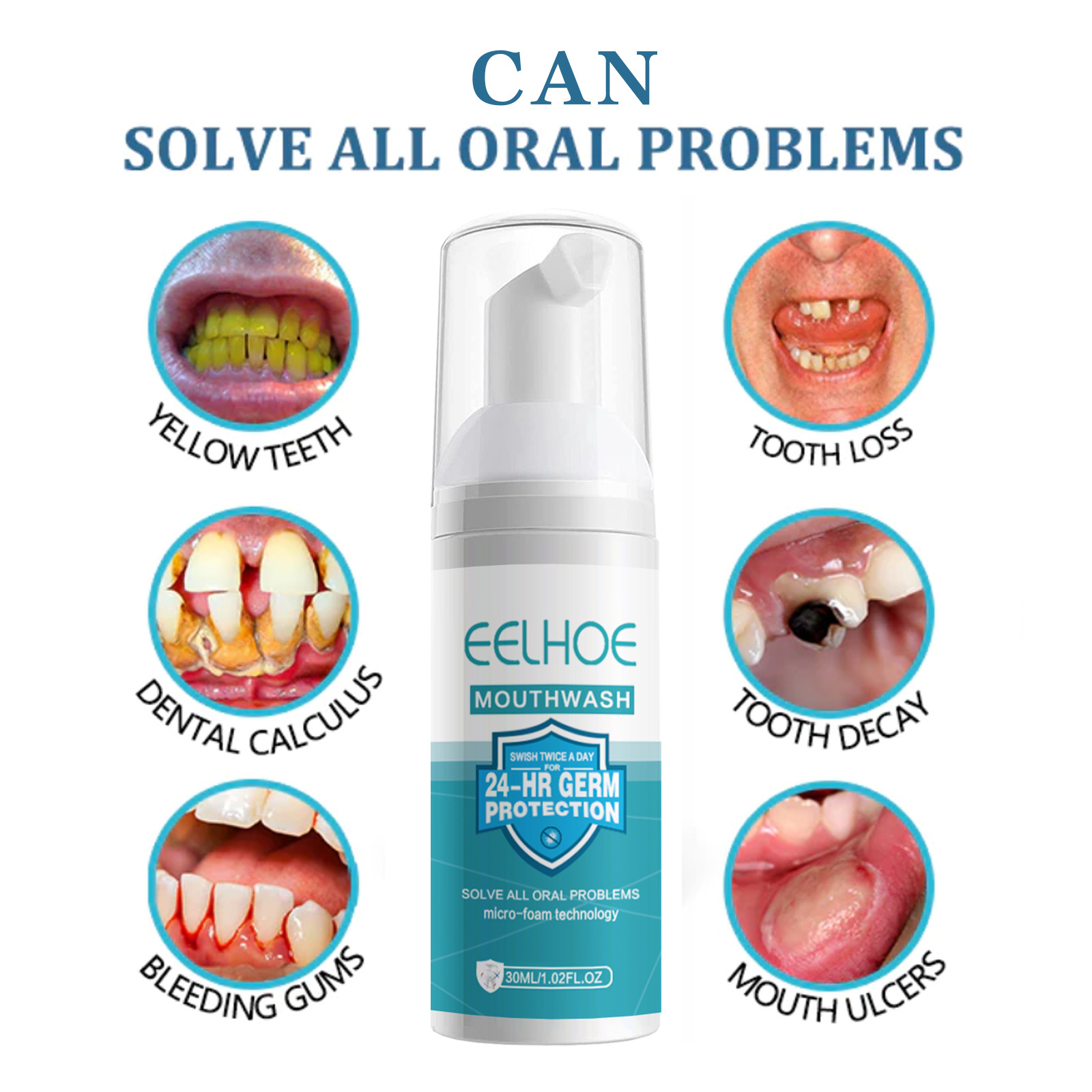 EELHOE Zahnaufhellung, Reinigu – Teeth Whitening Mousse Bewertung und Preis