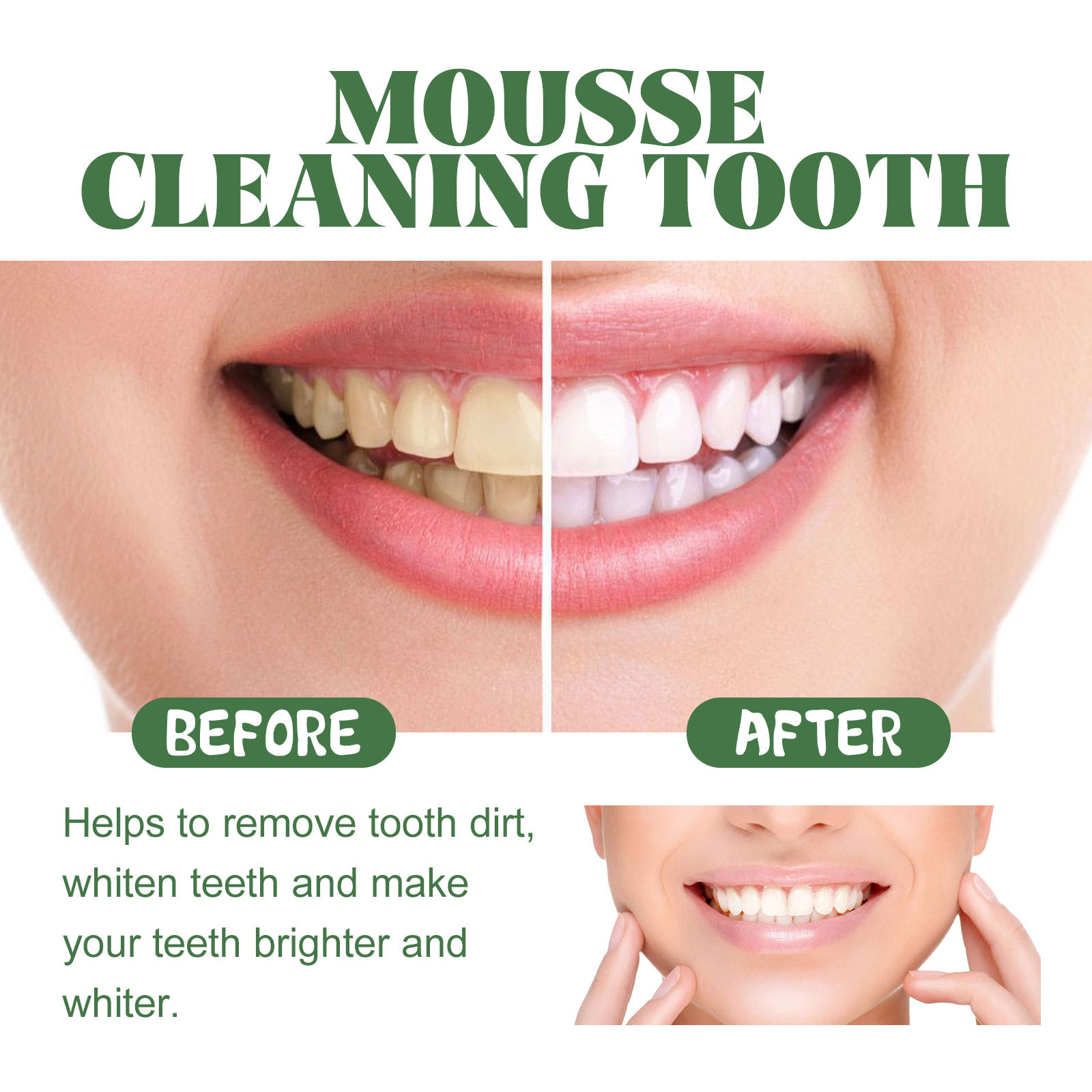 Tragbarer Reiseweiß-Schaum-Mou – Teeth Whitening Mousse Bewertung und Preis
