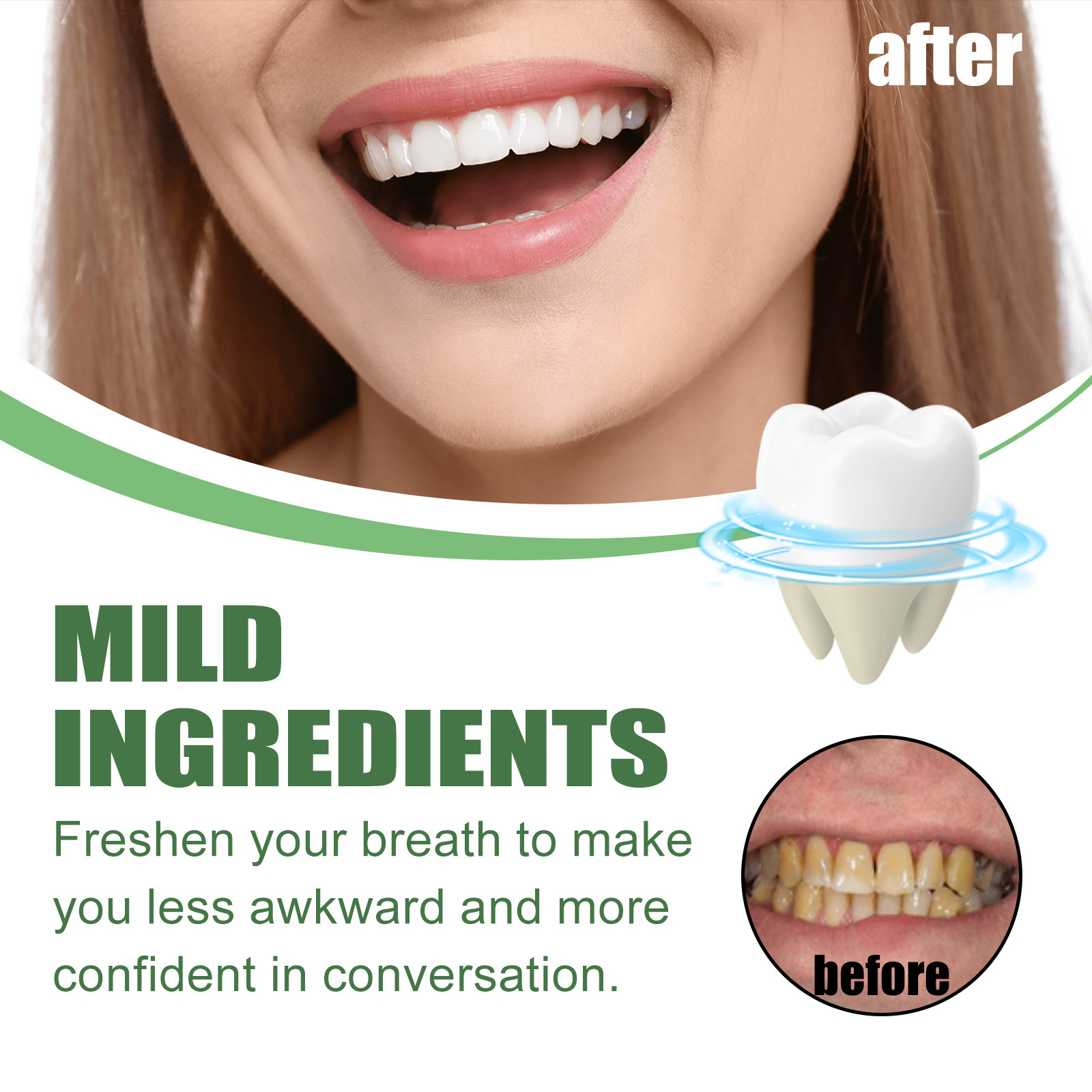 Tragbarer Reiseweiß-Schaum-Mou – Teeth Whitening Mousse Bewertung und Preis