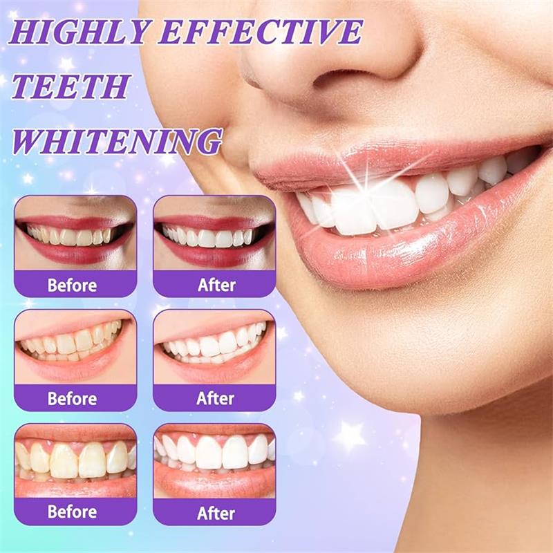 9D Lila Zahnaufhellungs-Zahnpa – Teeth Whitening Mousse Bewertung und Preis