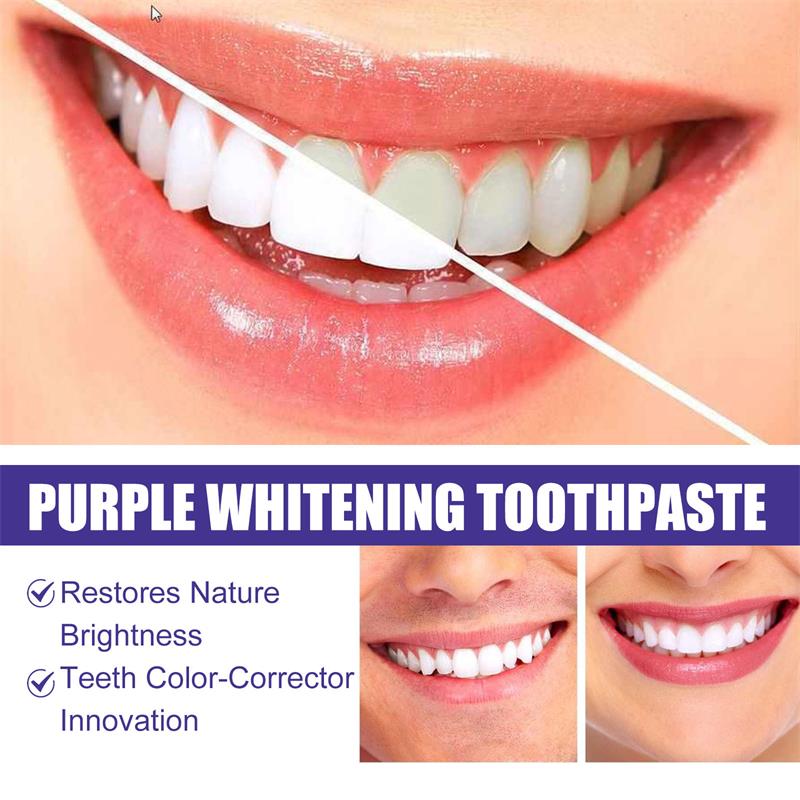 9D Lila Zahnaufhellungs-Zahnpa – Teeth Whitening Mousse Bewertung und Preis