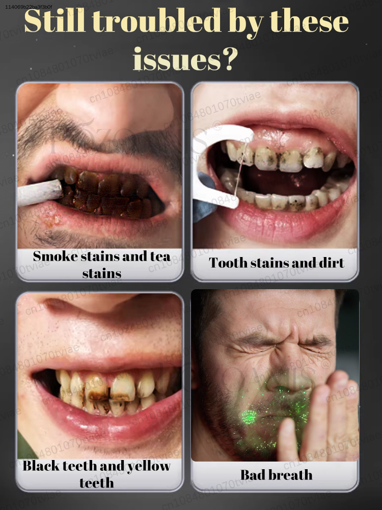 POZOAMIS 30% Hydroxyapatit-Zah – Teeth Whitening In Office Bewertung und Preis