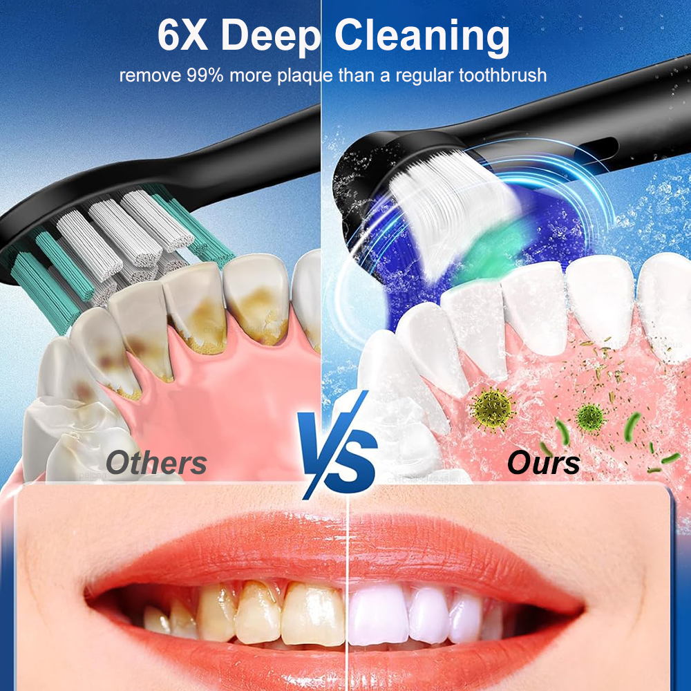 Elektrische rotierende Zahnbür – Teeth Whitening Gel Refills Bewertung und Preis