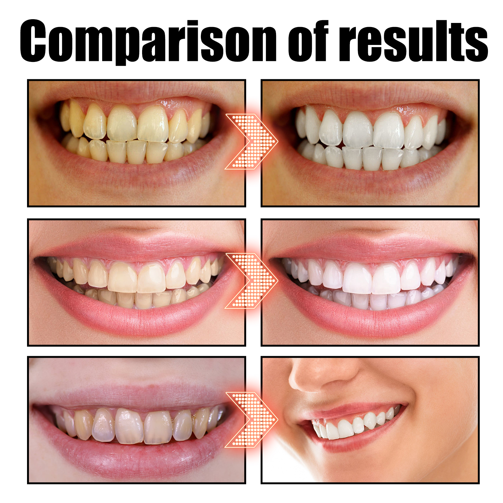 Kokosnussöl-Mundwasser zur Zah – Teeth Whitening Products Bewertung und Preis