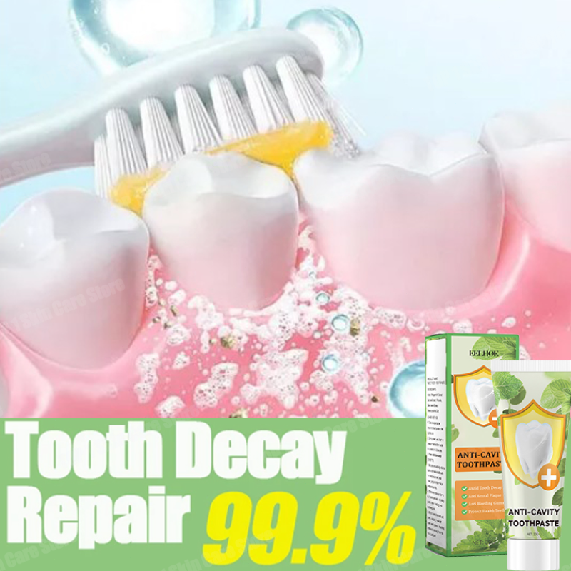 Anti-Karies-Zahnpasta reparier – Teeth Whitening Best Bewertung und Preis