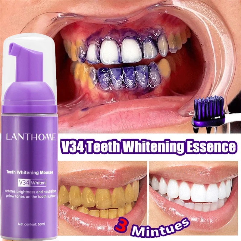 V34 Zahnaufhellung Mousse Zahn – Teeth Whitening Mousse Bewertung und Preis