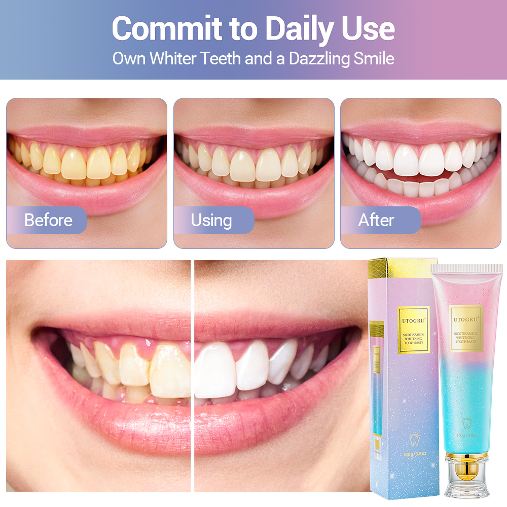 Aufhellende Zahnpasta, Nicotin – Teeth Whitening Best Bewertung und Preis