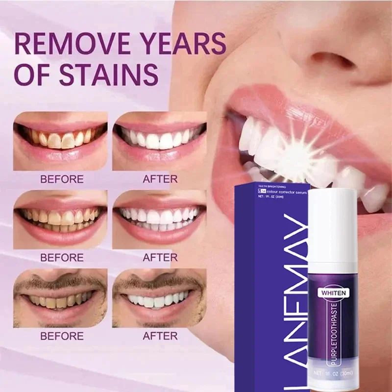V34 Lila Zähne Bleaching Zahnp – Teeth Whitening Mousse Bewertung und Preis