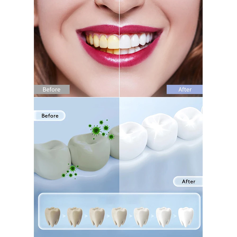 1PC Haushalt Smart LED Zähne B – Teeth Whitening In Office Bewertung und Preis
