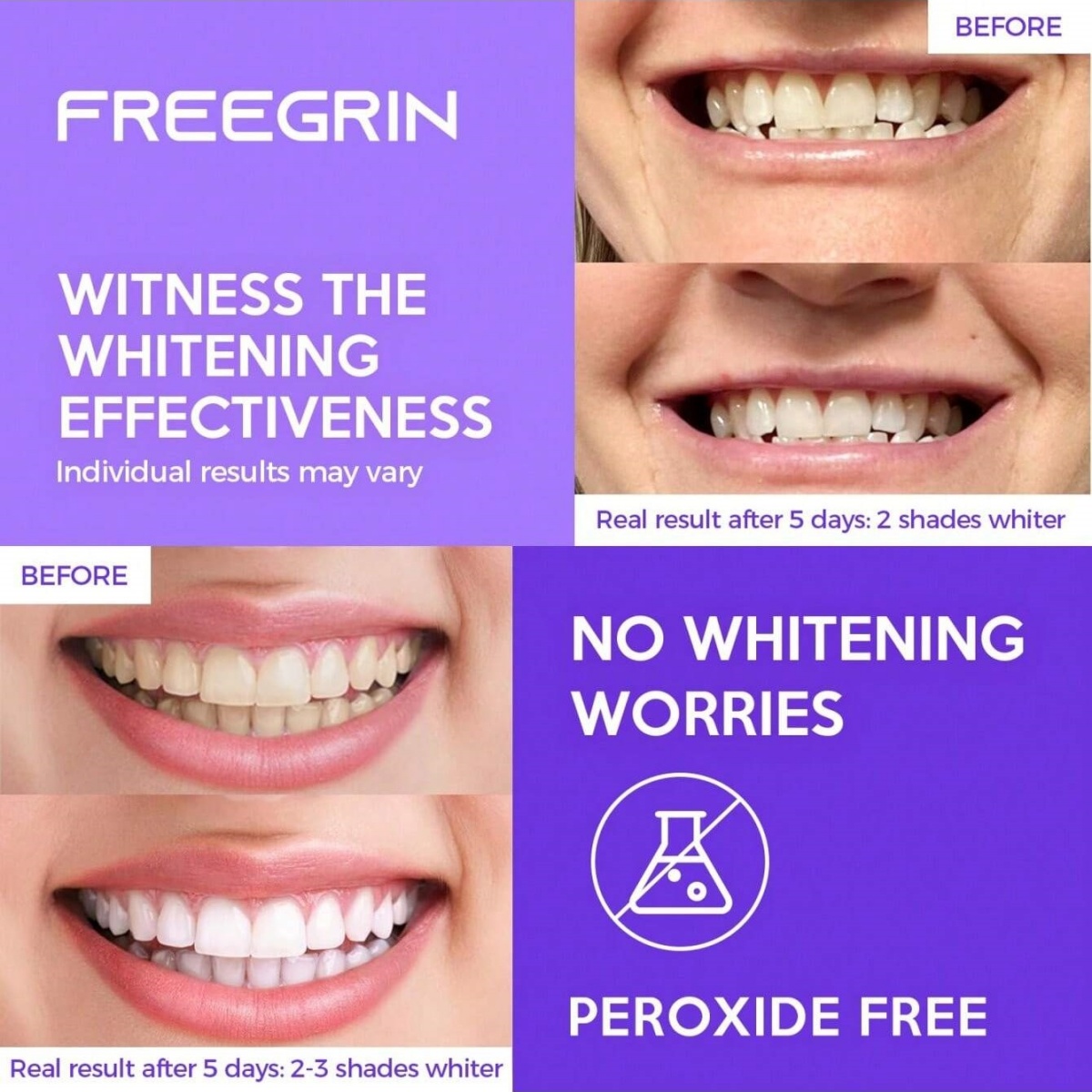 Deluxe Zahnaufhellungsaufklebe – Teeth Whitening In Office Bewertung und Preis