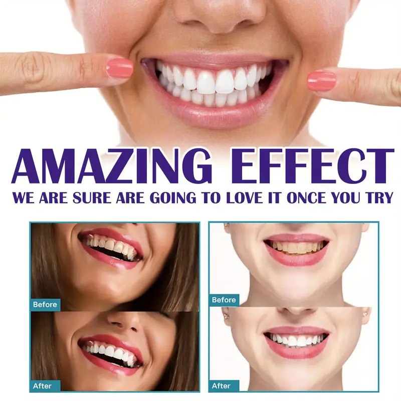Mousse v99 Zahnpasta Zahn rein – Teeth Whitening Mousse Bewertung und Preis