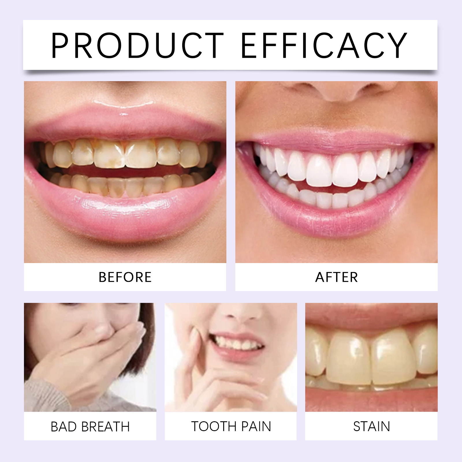 7PCS Bleaching reinigung Zähne – Teeth Whitening Gel Refills Bewertung und Preis