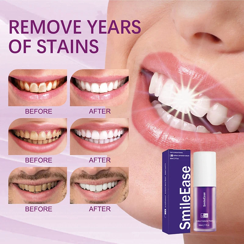 45 ml Smilekit Purple Tooth Mo – Teeth Whitening Best Bewertung und Preis
