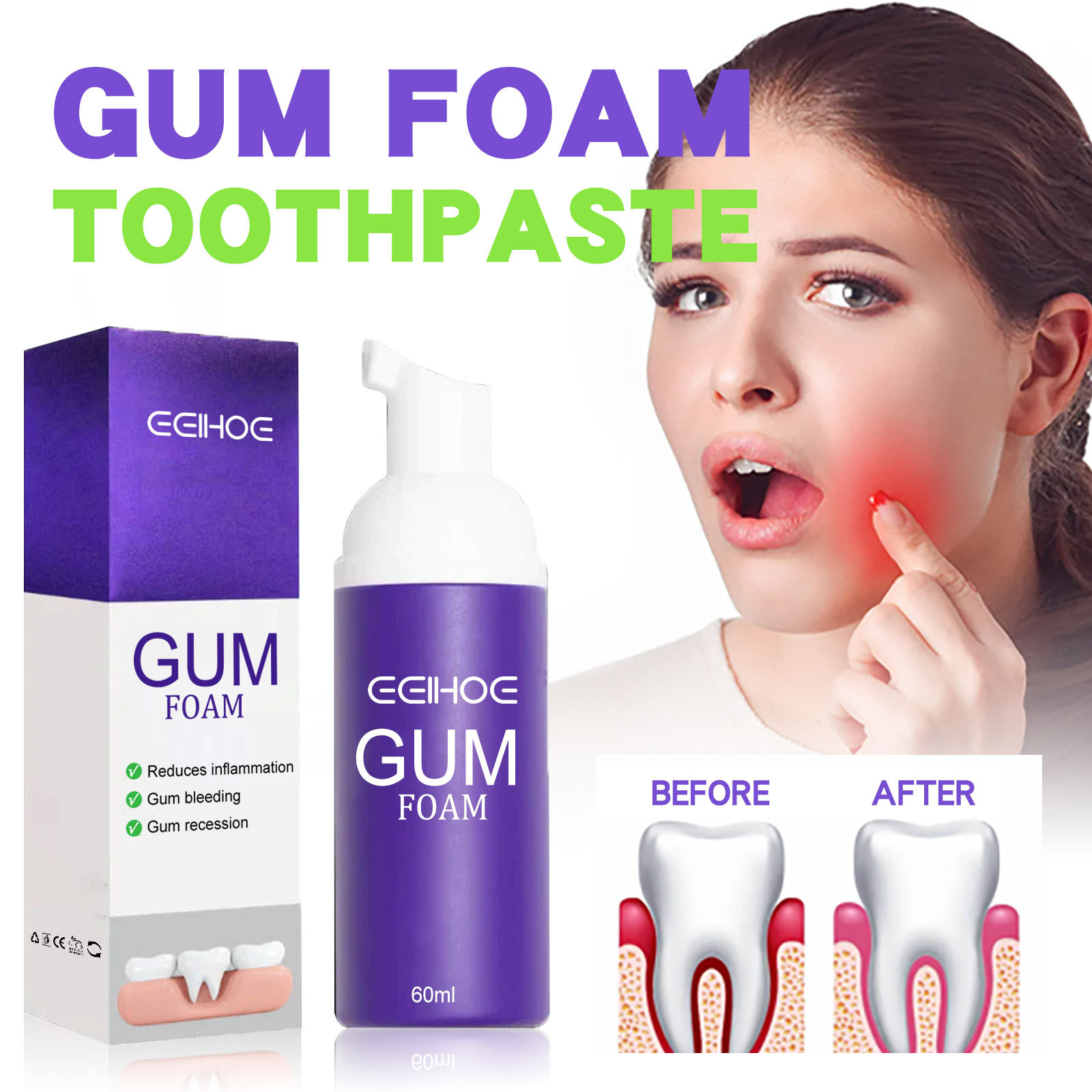 60 ml Zahnaufhellungsmousse V3 – Teeth Whitening Best Bewertung und Preis