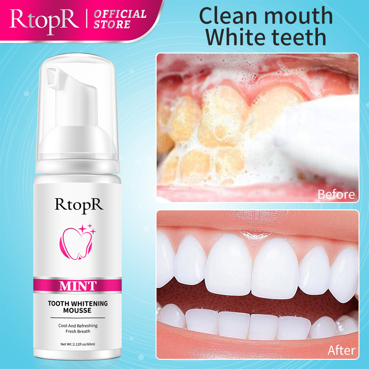 Rtopr Mint White ning Zähne Mo – Teeth Whitening Mousse Bewertung und Preis
