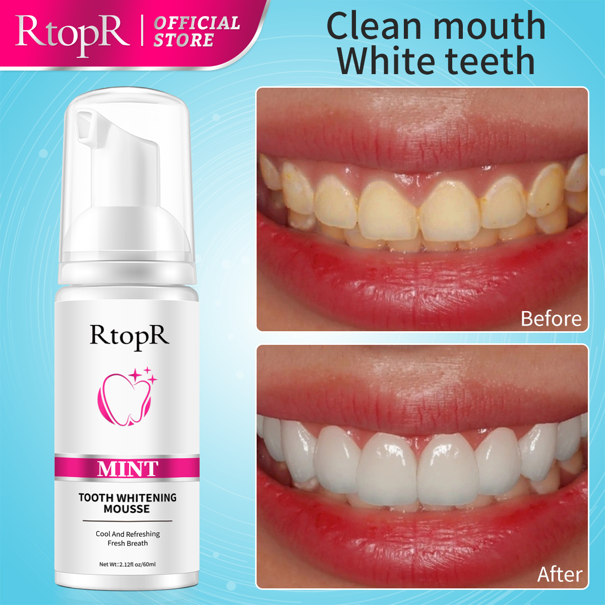 Rtopr Mint White ning Zähne Mo – Teeth Whitening Mousse Bewertung und Preis