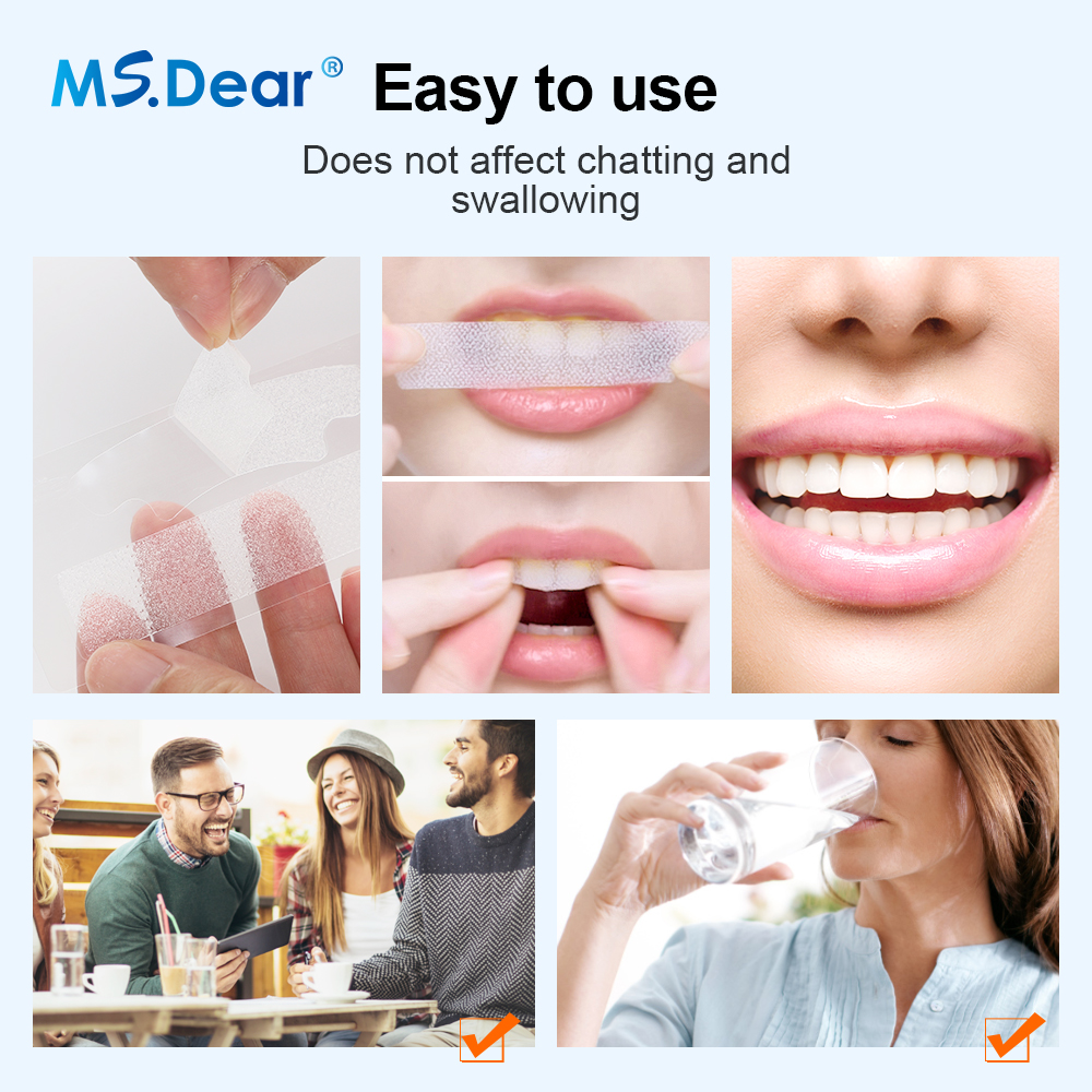 7/14/21/28/70 Pairs 9D Gel Zah – Teeth Whitening Gel Refills Bewertung und Preis