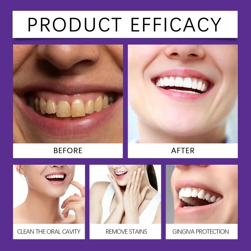 Lila Zahnrestaurations-Mineral – Teeth Whitening App Bewertung und Preis