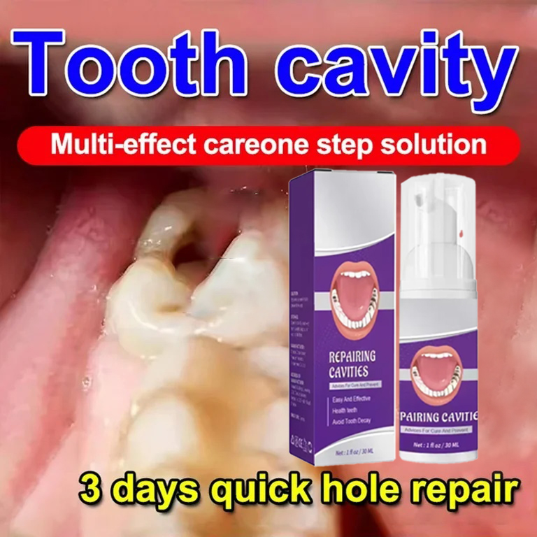 Zahnreinigung Zahnpasta Entfer – Teeth Whitening Best Bewertung und Preis