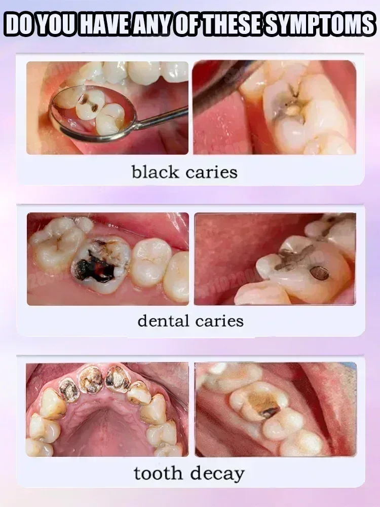 Zahnreinigung Zahnpasta Entfer – Teeth Whitening Best Bewertung und Preis