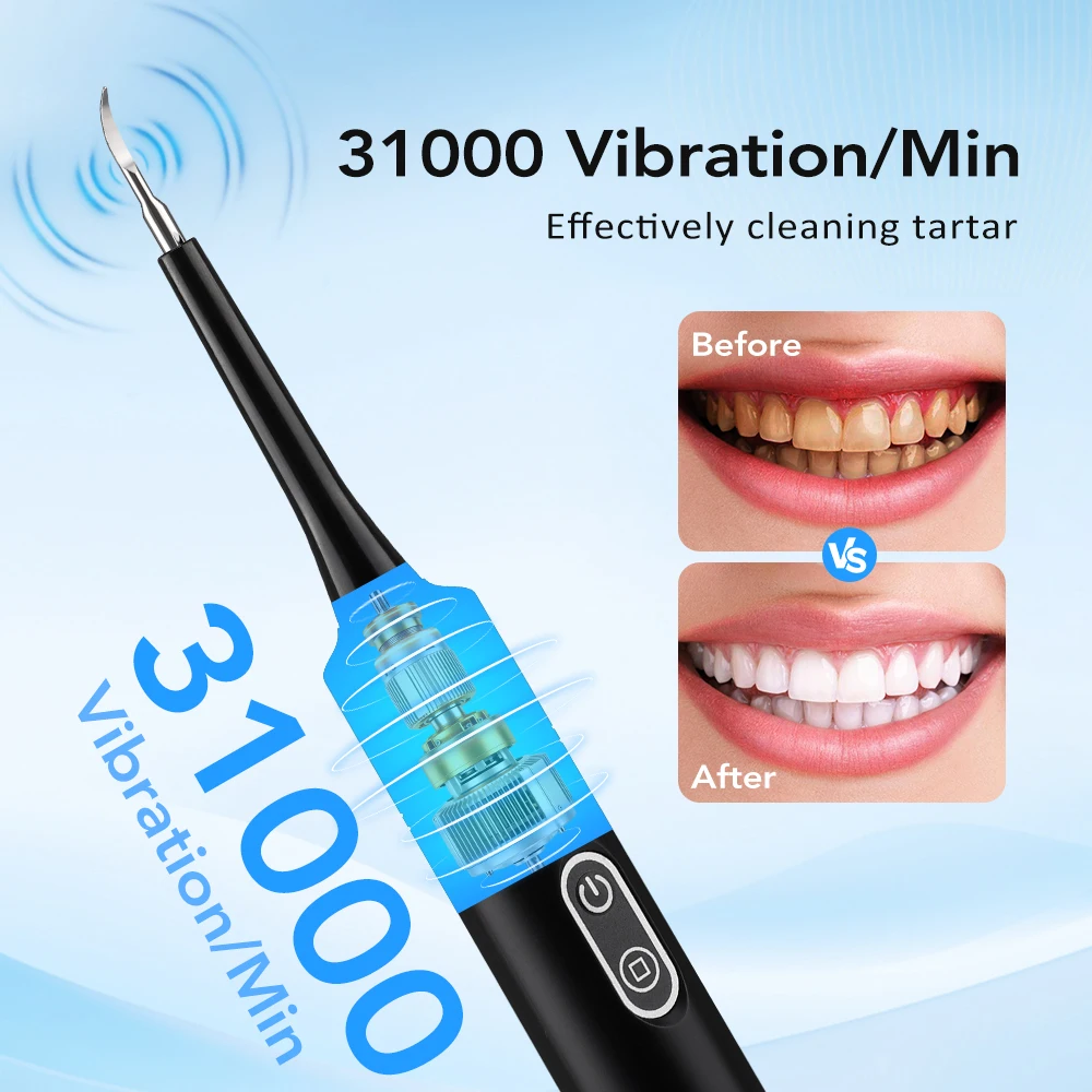Elektrischer Schallvibrations- – Teeth Whitening Products Bewertung und Preis