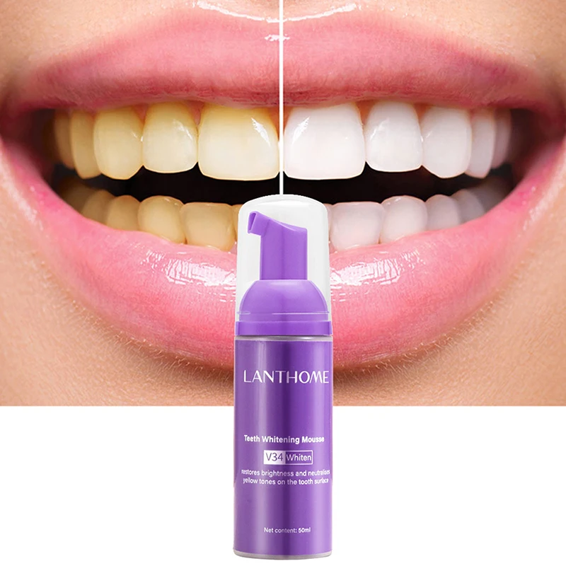 Mousse v34 Zahnpasta Zahn rein – Teeth Whitening Mousse Bewertung und Preis